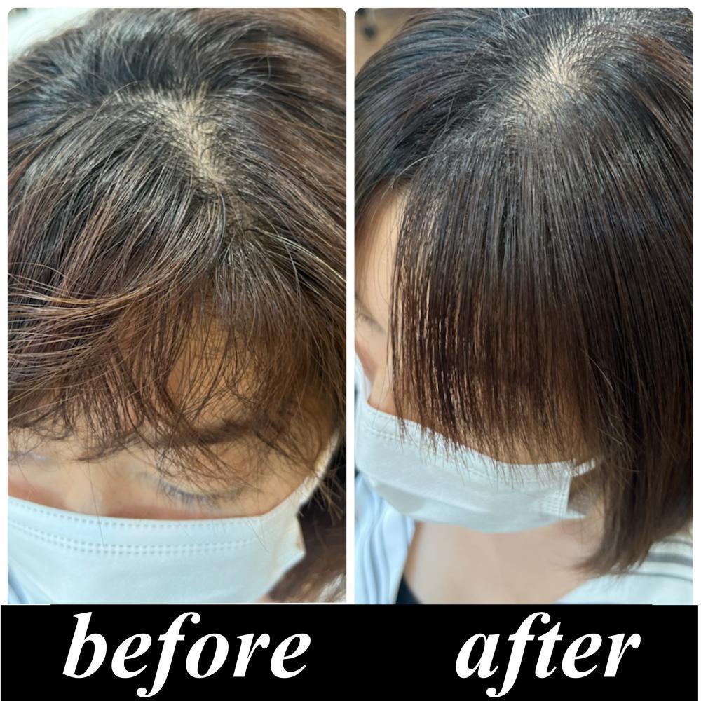 【美髪整形】異次元の最新髪質改善　シルク酸性ストレート(前髪